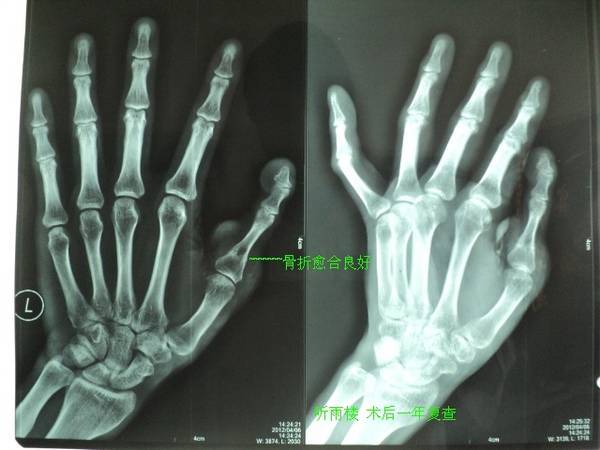 DSC00437_JPG_thumb.jpg