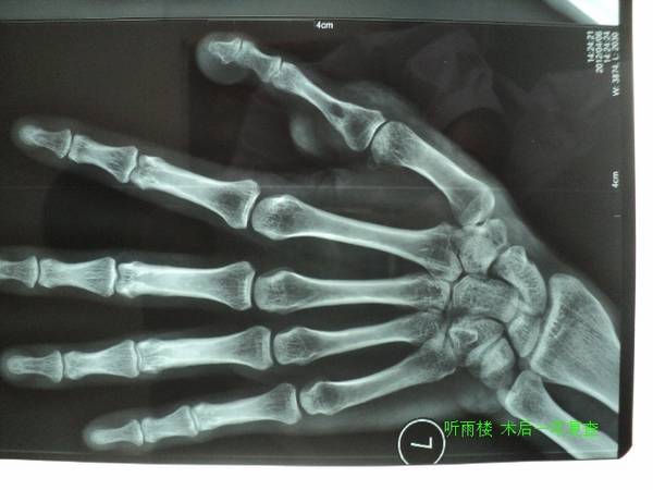 DSC00440_JPG_thumb.jpg