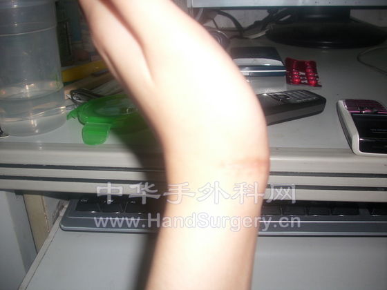 手腕2.JPG