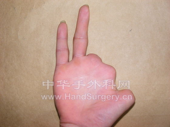 200904081547368AzZolIclxTIODpz.jpg