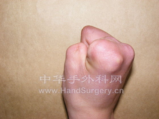 200904081549148AzZolIclxTIODpz.jpg