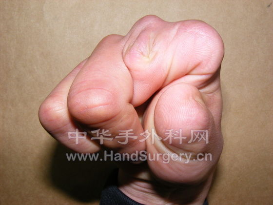 200904081551238AzZolIclxTIODpz.jpg