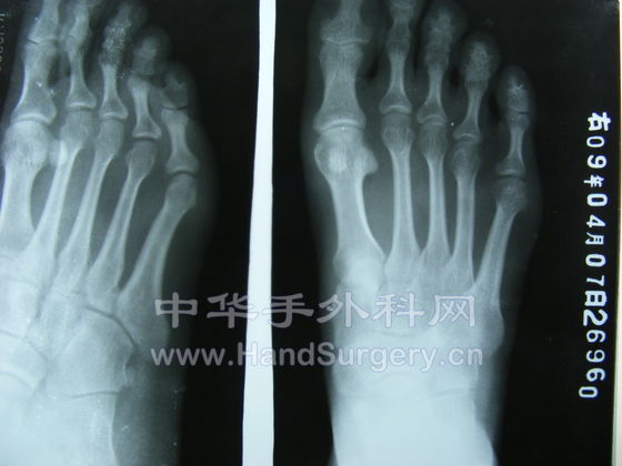 200904081606438AzZolIclxTIODpz.jpg