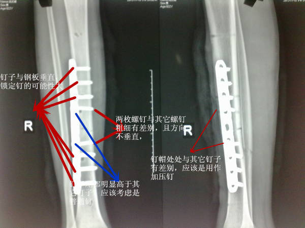 201311182479_jpg_thumb_副本.jpg