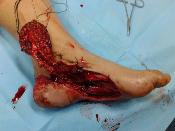 20140704_123304.jpg