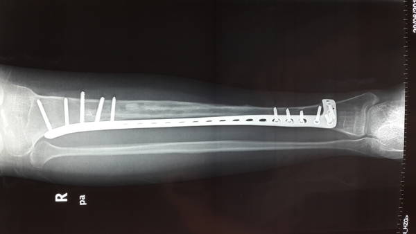 20140630_082201.jpg