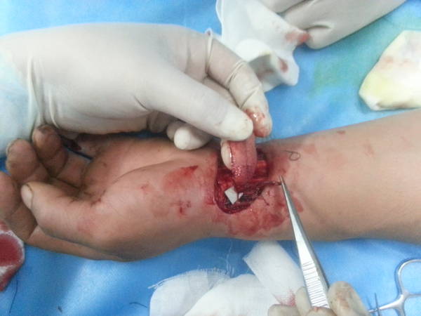 20140618_103427.jpg