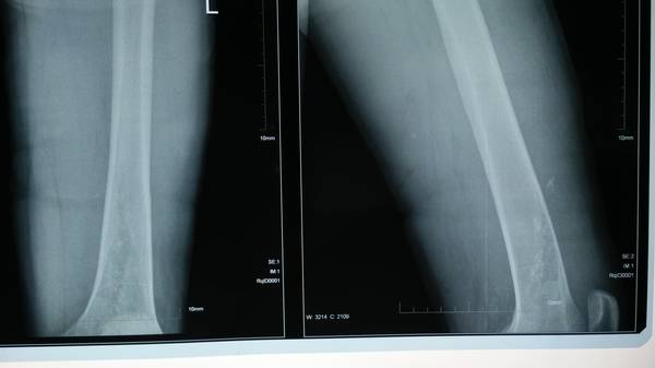 IMG20140912093352.jpg