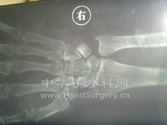 SNV33110.JPG