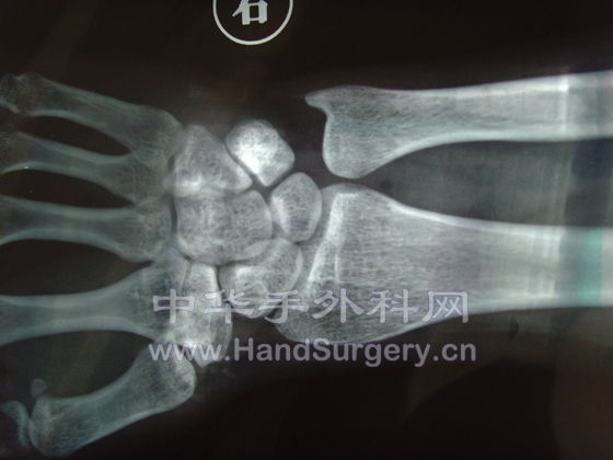 SNV33111.JPG