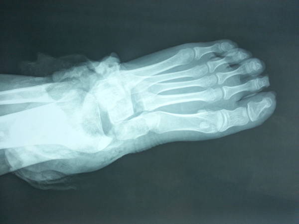 20140912_152519.jpg