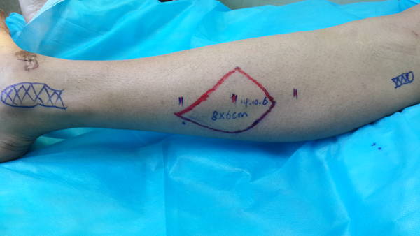 20141006_100144.jpg