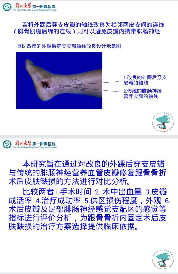 2014-11-10-22-41-30-1.png