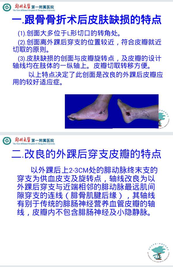 2014-11-10-22-43-42-1.png