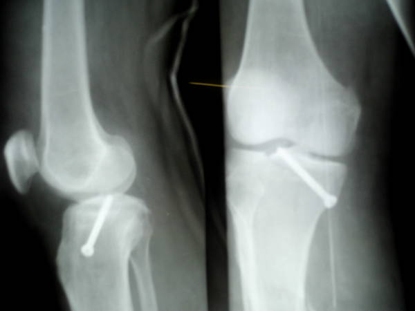 DSCI0648.JPG