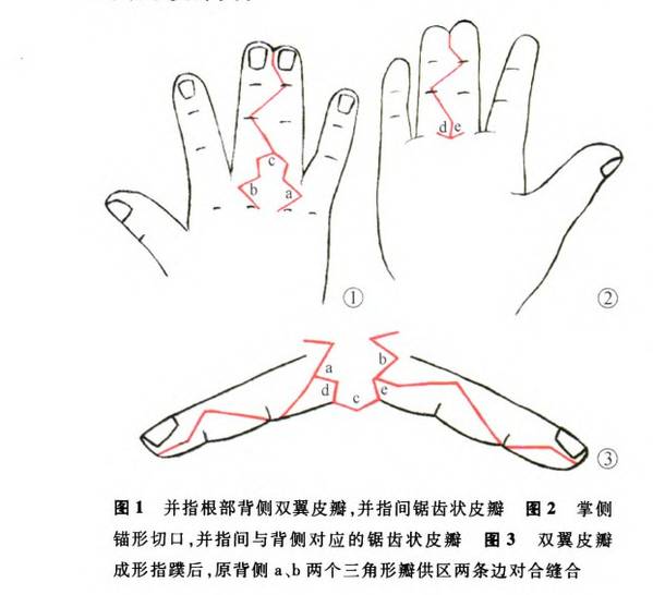 YY图片20150108212539.jpg