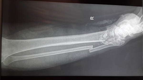 20141216_095642.jpg