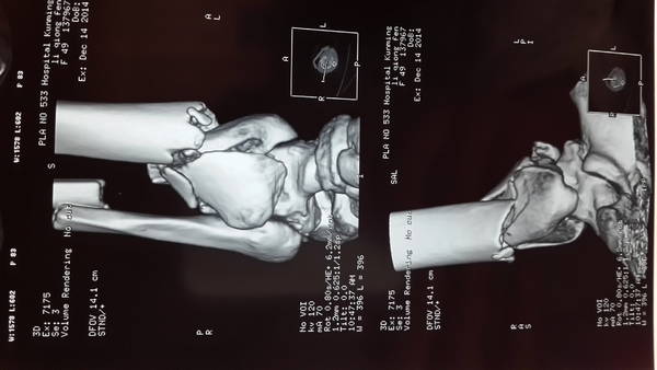 20141216_095726.jpg