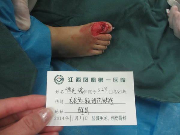 徐正瑞 右足皮肤缺损 (10).JPG