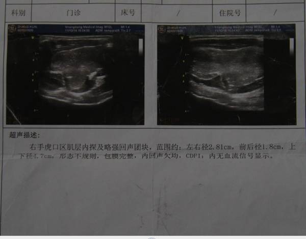 QQ图片20150310204534.jpg