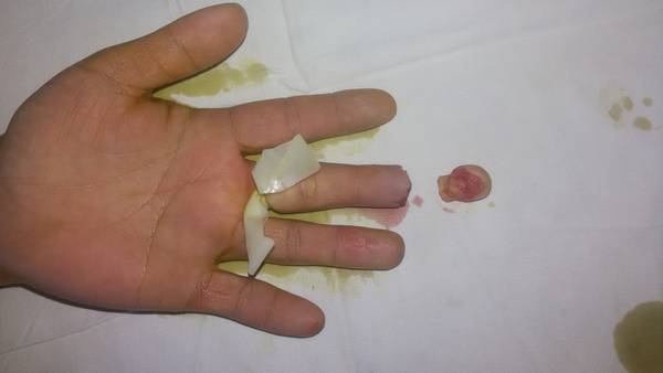 20150310_112956.jpg
