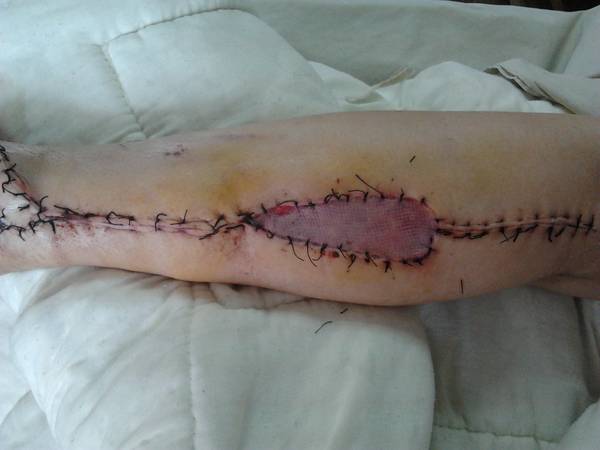 2011-07-22 08.26.34.jpg