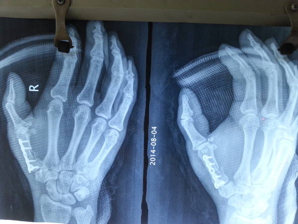 20140804_094134.jpg