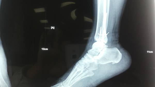 20150414_160454.jpg