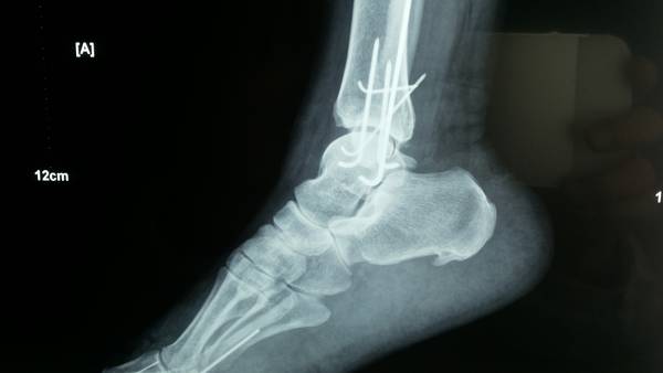 20150414_160541.jpg