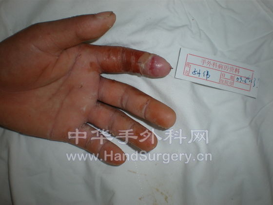孙伟0503.JPG