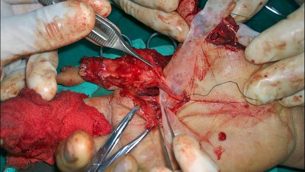 WP_20141008_15_50_00_Pro.jpg