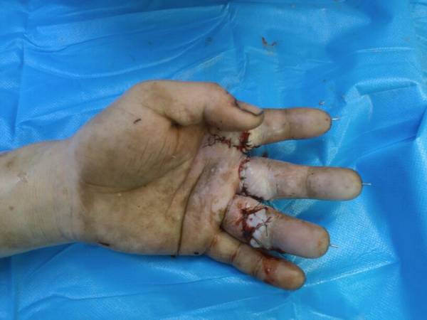 thumb9508.jpg