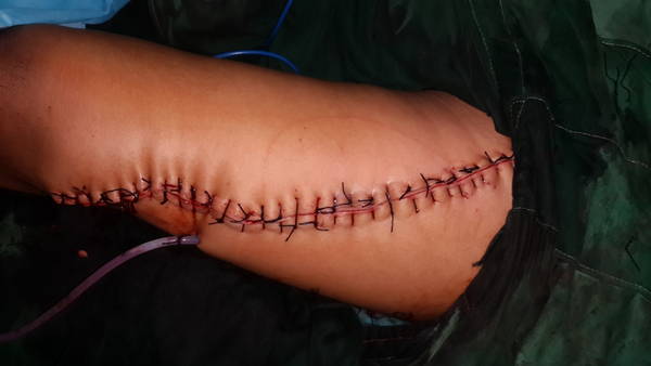 20150602_233654.jpg