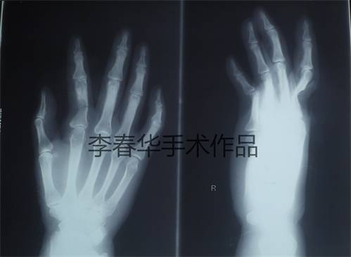 伤时