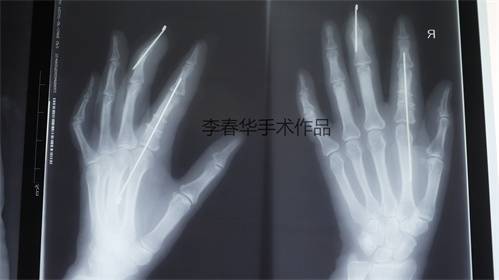 P1020859_看图王.jpg
