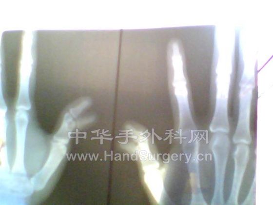 图片 004.jpg