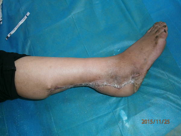 PB250308.JPG
