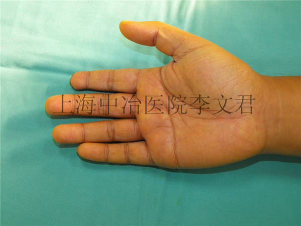术前