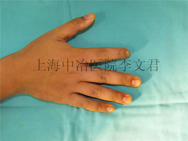 术前