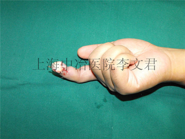 安装