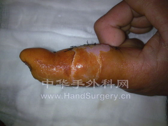 照片 500.jpg