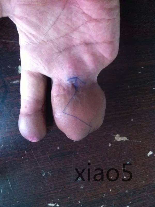 分支前设计2