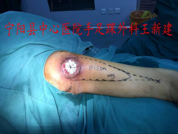 QQ图片20160308114938_conew1.jpg