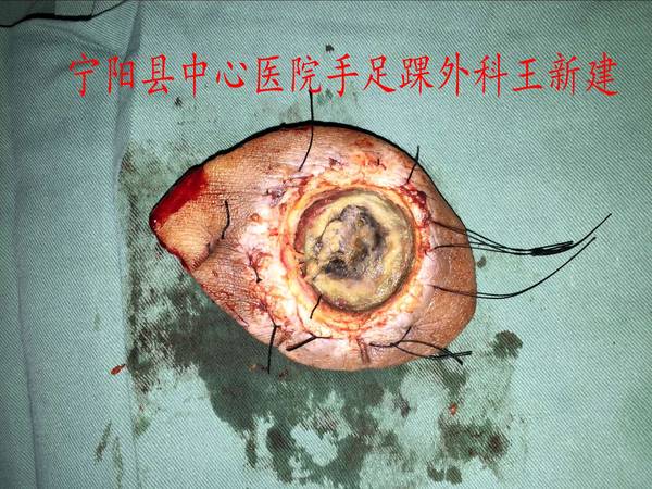 QQ图片20160308114934_conew1.jpg