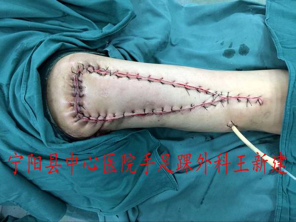 QQ图片20160308114948_conew1.jpg