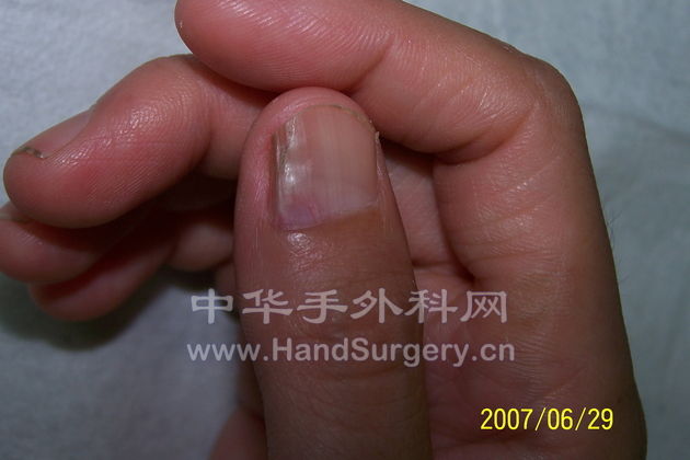 照片 003.jpg
