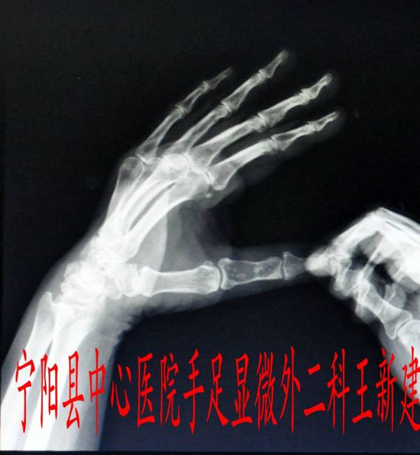 toYBAFe12UuABALXAAT7dW7QFBk324.jpg