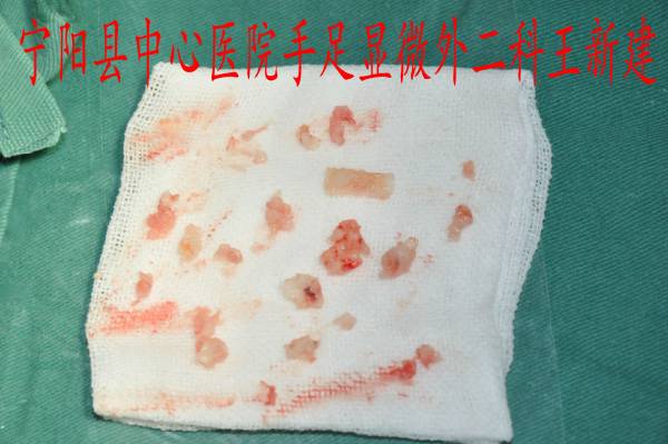 u4YBAFe12X2AQZ6UAAaZKRWeGBg433.jpg