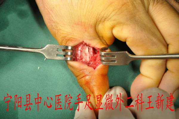 toYBAFe12ZaAdX_RAAZ6D_QRDzg376.jpg