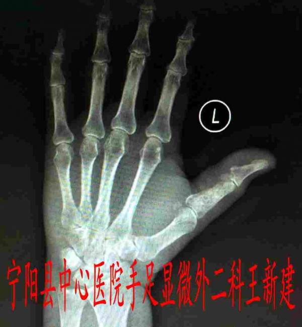 toYBAFe23dCAJUyUAACV1ecT0Ak343.jpg